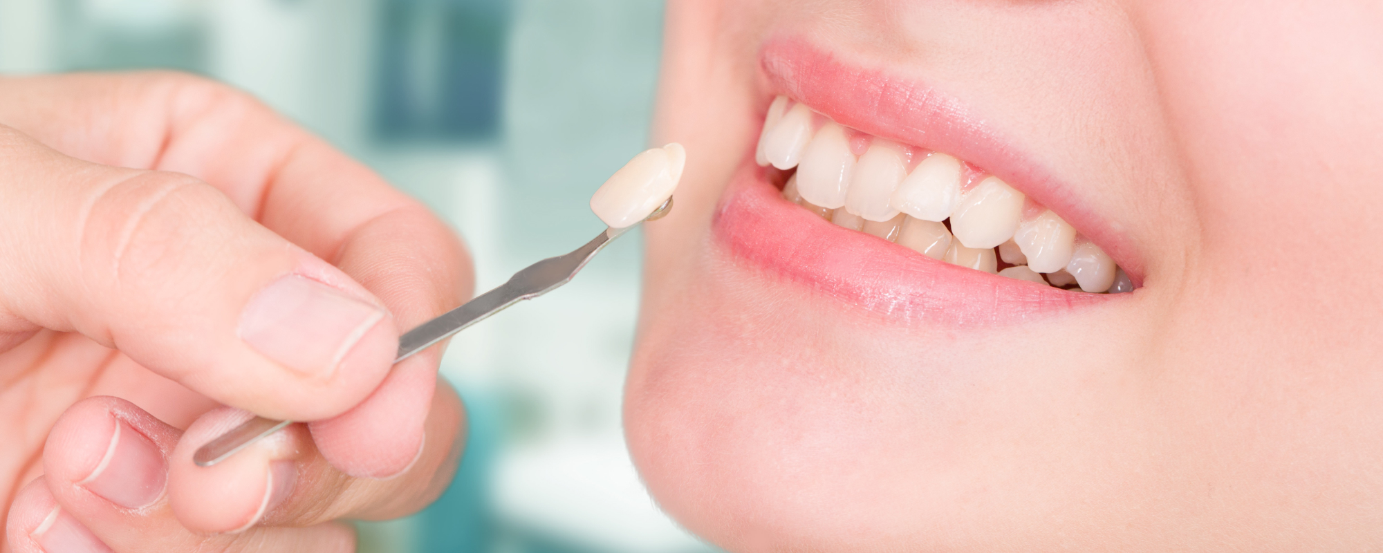 LongTerm Considerations Do Veneers Damage Your Teeth?