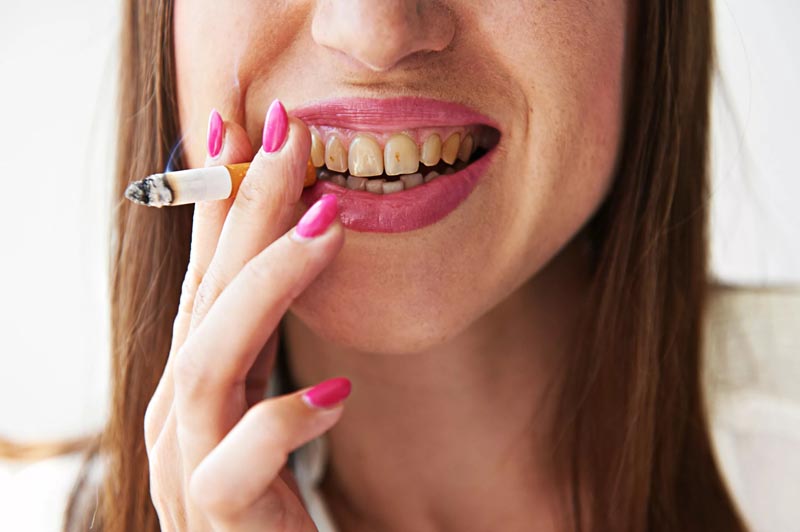 yellow teeth because of smoking