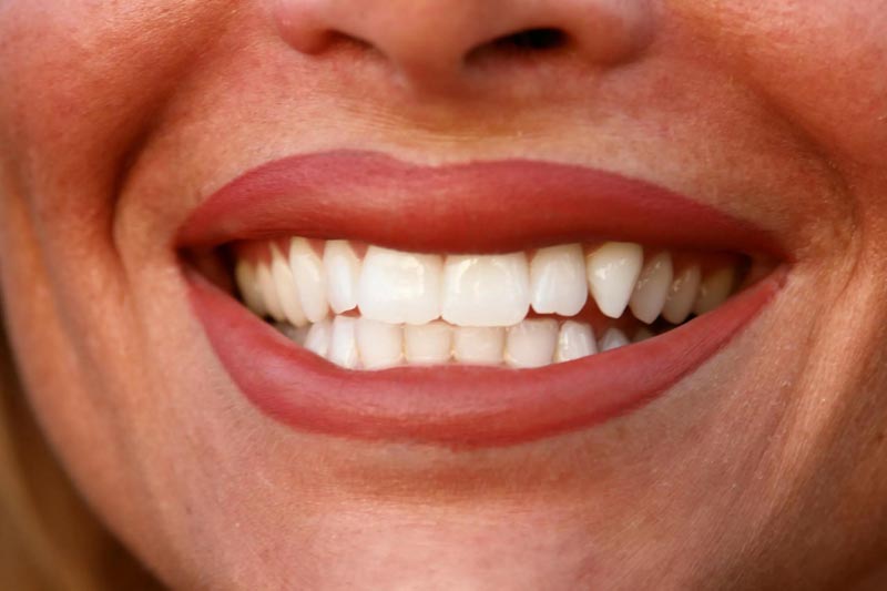 Woman showing her teeth