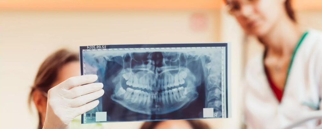 dental x ray